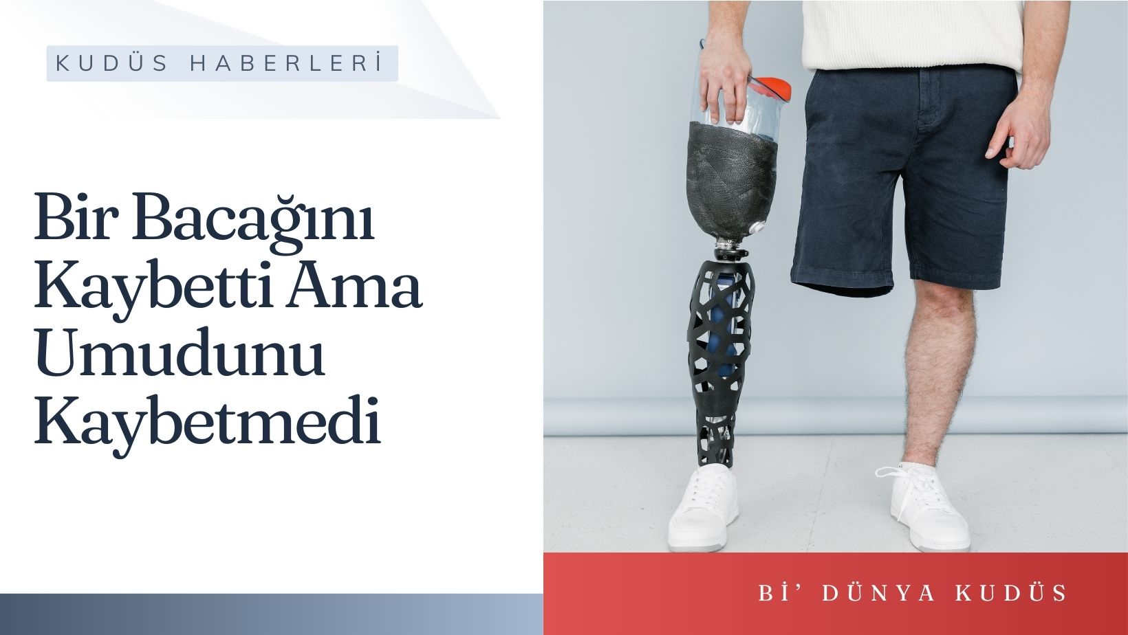 Bir Bacağını Kaybetti Ama Umudunu Kaybetmedi